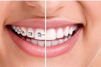 Orthodontie